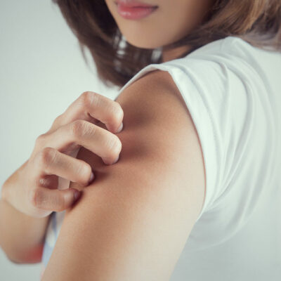 10 common signs of itchy skin