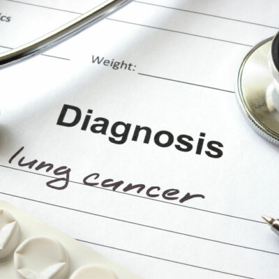 Common signs of lung cancer that should not be ignored